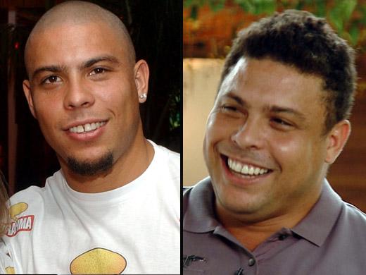 Ronaldo antes e depois